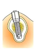 Clinica de estetica y colocacion de implantes dentales de odontologia.