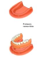 Estetica y colocacion de implantes dentales de odontologia.