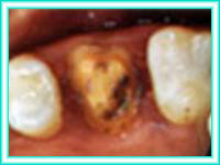 Clinica de odontologia estetica y colocacion dental.