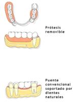 Dental implant surgeries in aesthetics and aesthetics.