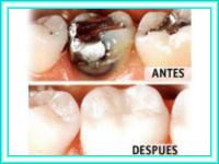 Placing dental aesthetics and dental clinic.
