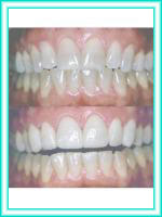 Implant teeth and dental clinic aesthetics.