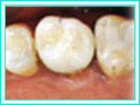 Dental implant clinic in placement of teeth.