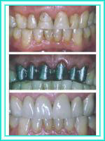 Dental implant and aesthetic dental clinic.