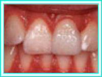 Dentistry aesthetics dental clinic aesthetics.