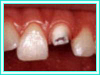 Dental aesthetics and placement of teeth.