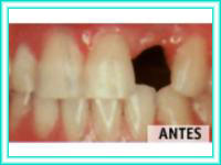 Dental aesthetics in aesthetics dental clinic.